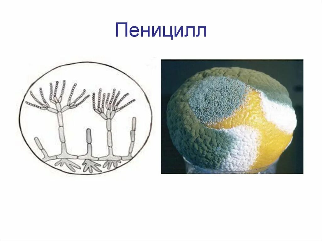 Плесневые грибы и антибиотики. Строение плесени пеницилл. Плесневый гриб пеницилл. Сизая плесень пеницилл. Пенициллин плесневый гриб.