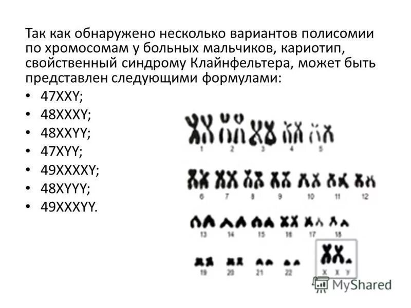 Хромосомный набор клайнфельтера. Синдром клайнфельтера идиограмма. Синдром клайнфельтера кариограмма. Синдром клайнфельтера генотип. Xxy синдром клайнфельтера кариотип 47.