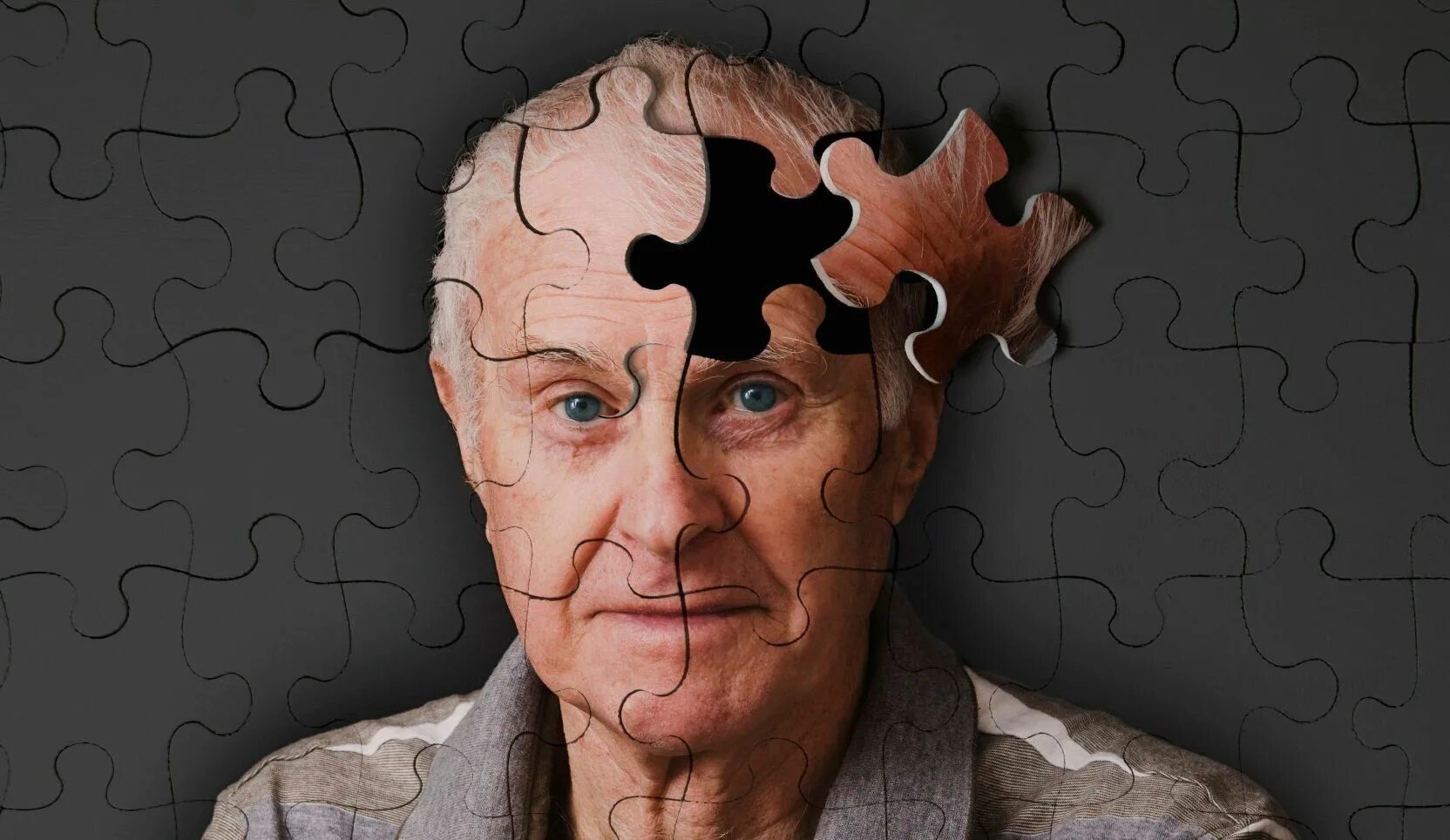 Человек с болезнью альцгеймера. Болезнь альцгеймера деменция. старческое слабоумие деменция. тони беннетт болезнь альцгеймера. энн вудс болезнь альцгеймера.