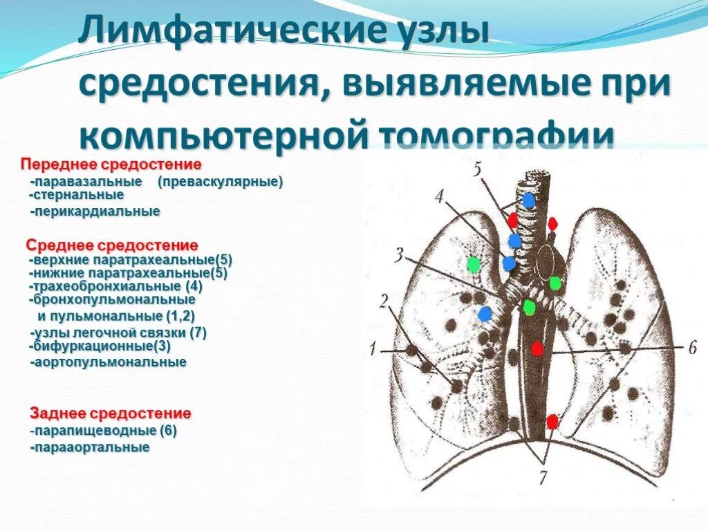 Легкие увеличен узел. Лимфоузлы средостения кт норма. Внутригрудные лимфоузлы кт схема. Группы внутригрудных лимфатических узлов на кт. Лимфоузлы средостения внутригрудные лимфоузлы.