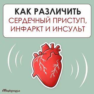 Приступ инсульта