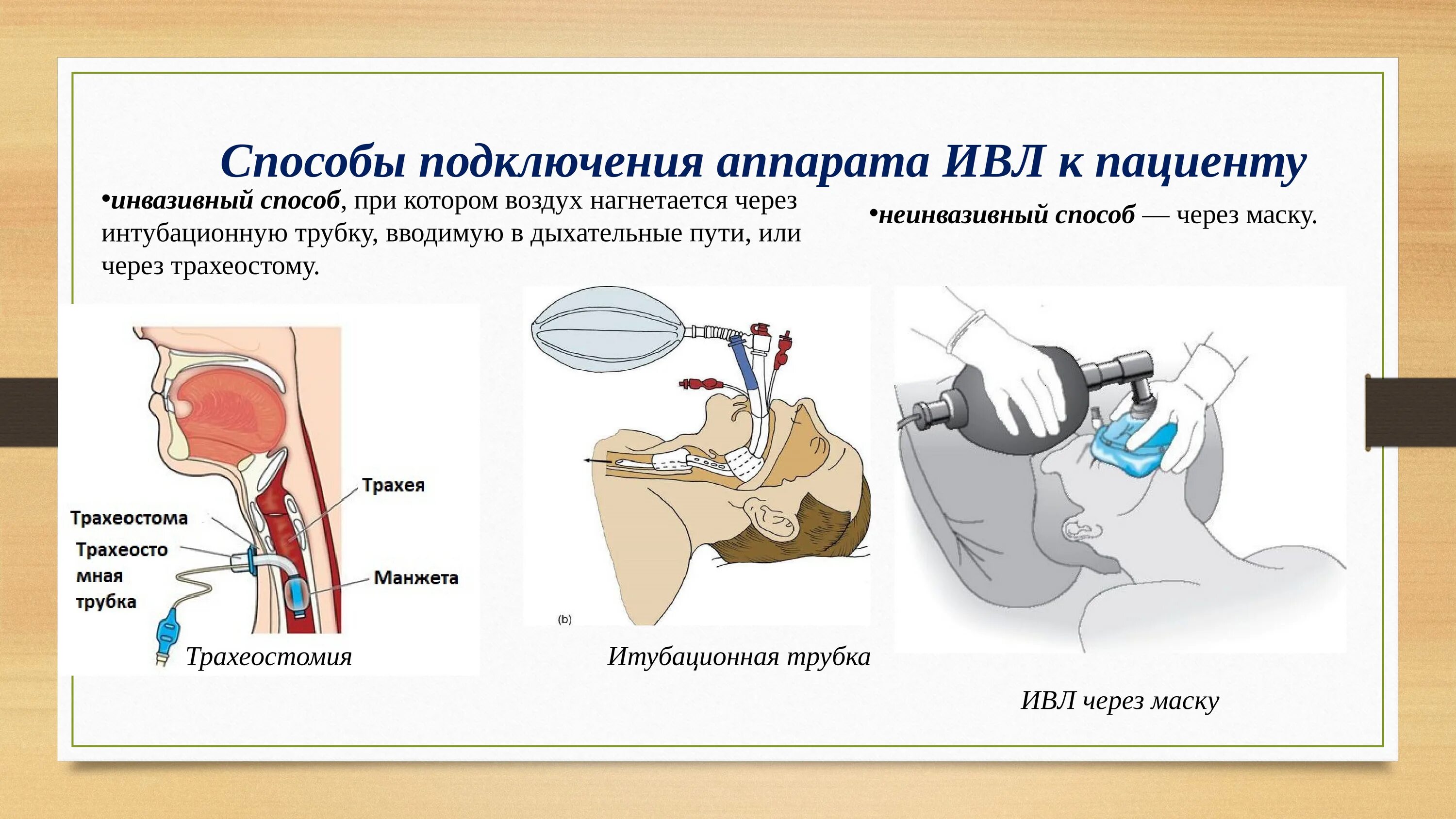 Искусственный воздух для дыхания. Аппарат искусственной вентиляции легких с трубкой. ИВЛ через интубационную трубку. ИВЛ для неинвазивной вентиляции легких. Искусственная вентиляция легких алгоритм аппаратом.