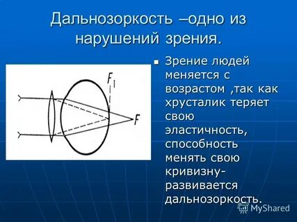 Пресбиопия глаз