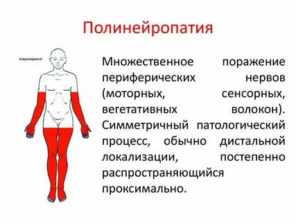 Полинейропатия нижних конечностей симптомы причины и лечение