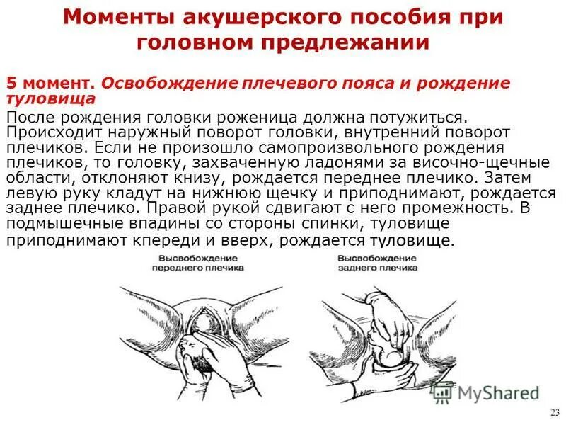 Самопроизвольное предлежание. Акушерское пособие при головном предлежании. Ручное пособие при головном предлежании. Ручное акушерское пособие. Акушерское пособие при физиологических родах.