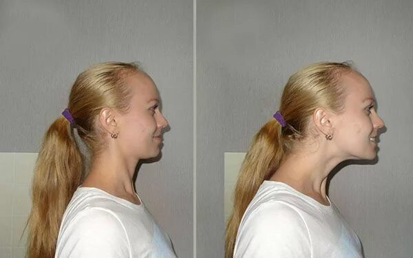 Выступает вперед. Выступающий на сцене. Звезды с длинным подбородком. Выступающий подбородок. Современные ораторы.