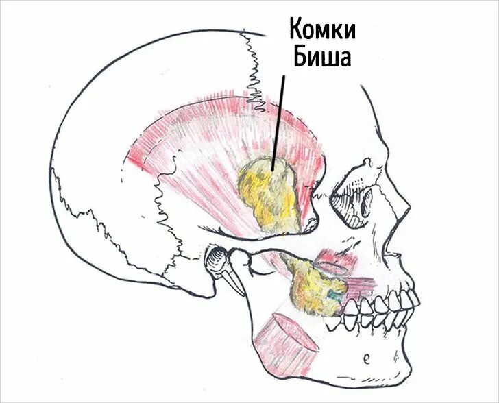 Жировой комок. Жировые пакеты под глазами. Жировой комок биша топографическая анатомия. Гравитационный птоз лица жировые пакеты. Комочек биша топографическая анатомия.