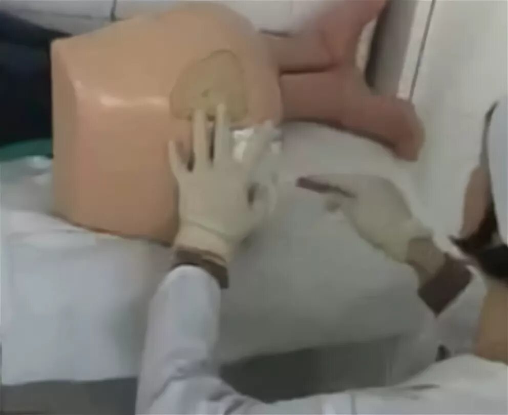 Очистительная клизма в больнице. Желудочный зонд для промывания желудка техника. Очистительная клизма. Постановка очистительной клиз. Делают большую клизму видео.