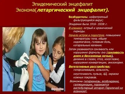 Летаргический энцефалит