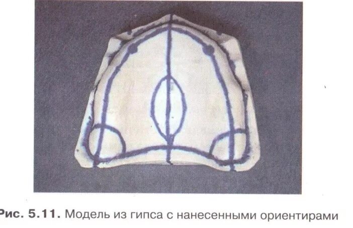 Границы полного съемного протеза верхнего. Границы полного съемного протеза верхнего