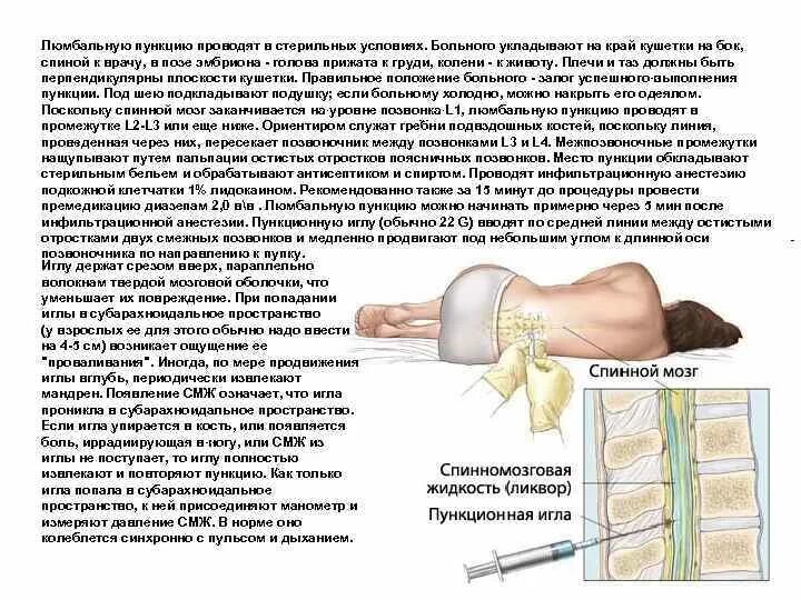 Люмбальная пункция положение пациента. Методика выполнения люмбальной пункции. Люмбальная пункция неврология. Люмбальная пункция техника неврология.