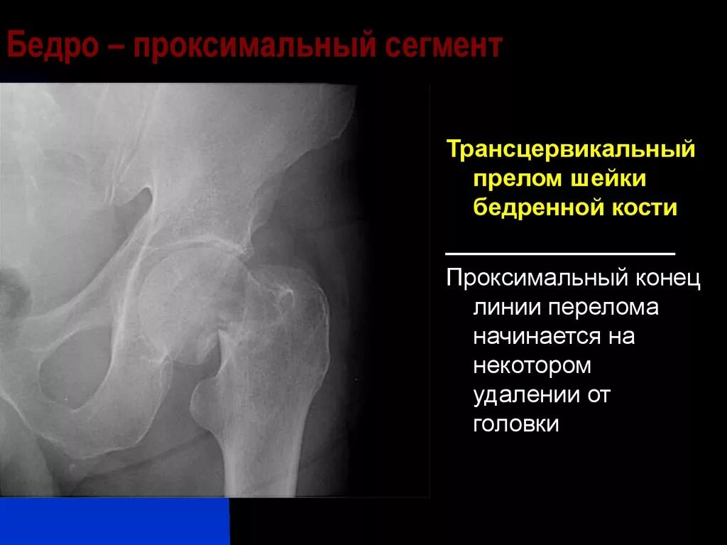 Проксимальный сегмент. Проксимальный сегмент
