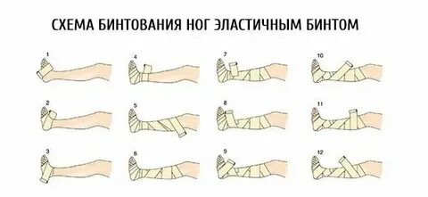 Как правильно бинтовать ноги после эндопротезирования