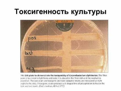 Определение токсигенности дифтерии