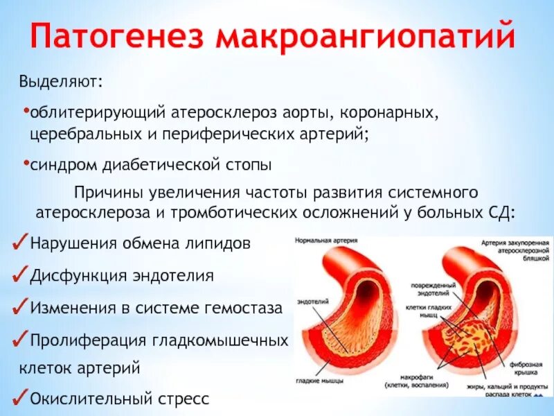 Атеросклероз аорты что это такое простыми. Атеросклероз аорты венечных артерий. атеросклероз коронарных сосудов осложнения. осложнения атеросклероза аорты. атеросклероз аорты и коронарных сосудов.