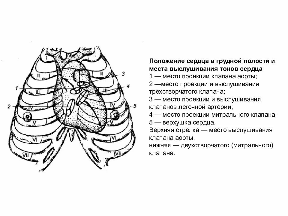 Проекция клапанов сердца на грудную клетку схема. Точки проекции и выслушивания клапанов сердца. Проекция границ сердца на грудную клетку. Проекции и точки аускультации клапанов сердца. Клапаны сердца на грудной клетке