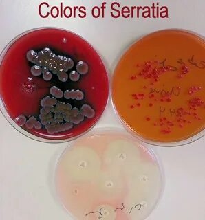 Serratia marcescens