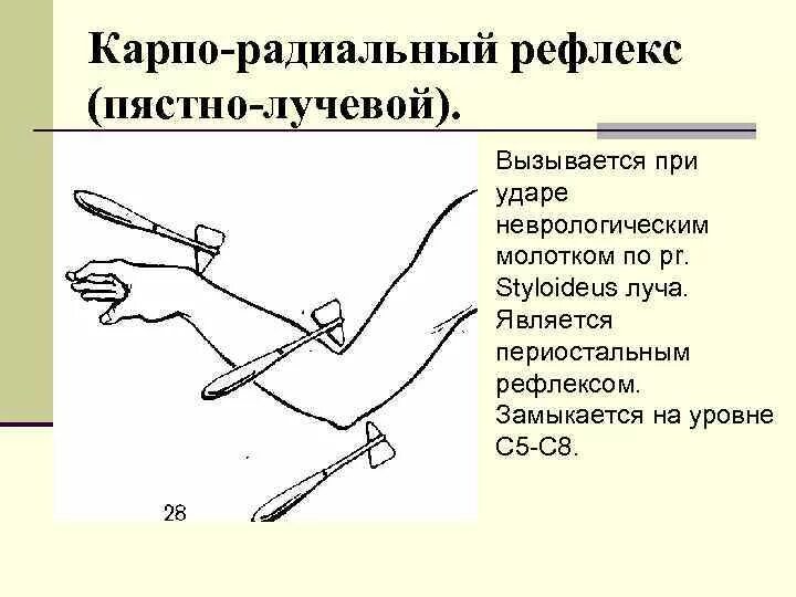 Исследование карпорадиальный рефлекс. Запястно лучевой рефлекс. Пястно лучевой рефлекс рефлексы. Карпорадиальный (запястно-лучевой) рефлекс.