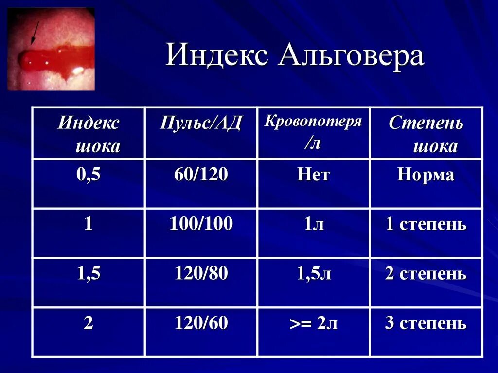 Индекс кровотечения. Индекс Альговера степени шока. Шоковый индекс Альговера в норме. Индекс Альговера-Грубера это. Шоковый индекс Альговера таблица.