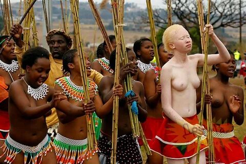 Конкурс "Мисс-альбинос" впервые прошел в Зимбабве 