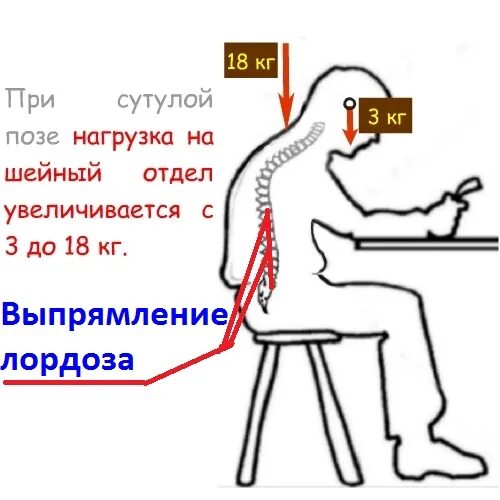 Нарушение статики выпрямление лордоза. Шейный лордоз выпрямлен. шейный лордоз выпрямлен рентген. лордоз шейного отдела позвоночника. выпрямление шейного лордоза.