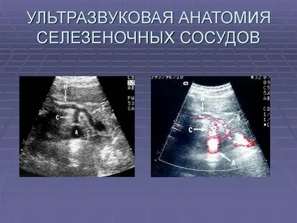 Ультразвуковая анатомия