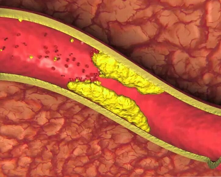 Сосуды внутри. Сосуды внутри. Сосуды внутри. Расширение кровеносных сосудов. Кровеносные сосуды.