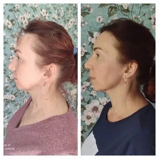 Фото фейсбилдинга