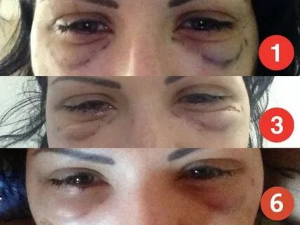Становится плохо на операции