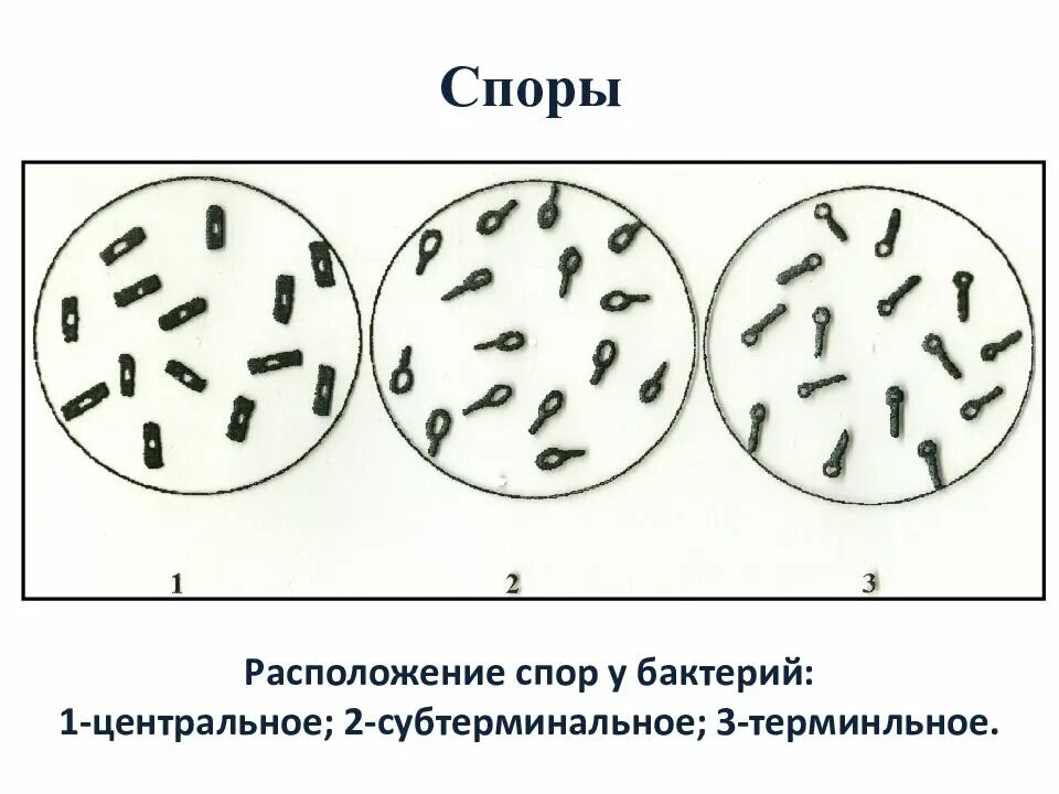 Какие бывают споры. Варианты расположения спор микробиология. Расположение спор у бацилл. Споры бактерий микробиология. Споры бактерий расположение.