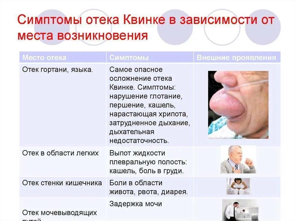 Температура горло нос симптомы