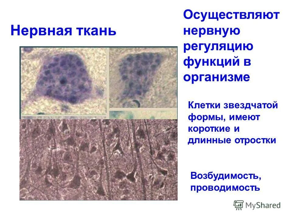 клетки звездчатой формы имеет ткань. нейроны по форме перикариона. специализированные клетки тканей. астроцитная глия функции. астроцитная глия.