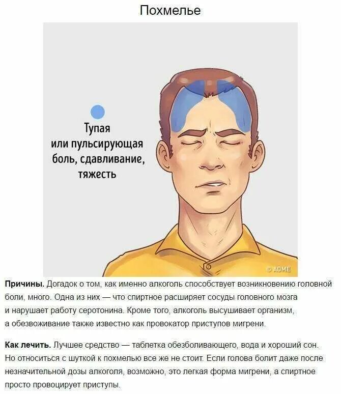 Почему болят виски головы и глаза. Типы головной боли. Головная боль локализация. Боль в висках головы. Причины головной боли.