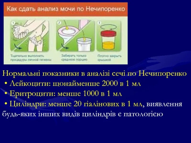 Как сдавать мочу на анализ мужчине. Исследование мочи по Нечипоренко. Посев мочи по Нечипоренко. Сдача анализа мочи по Нечипоренко. Моча по Нечипоренко как сдавать.