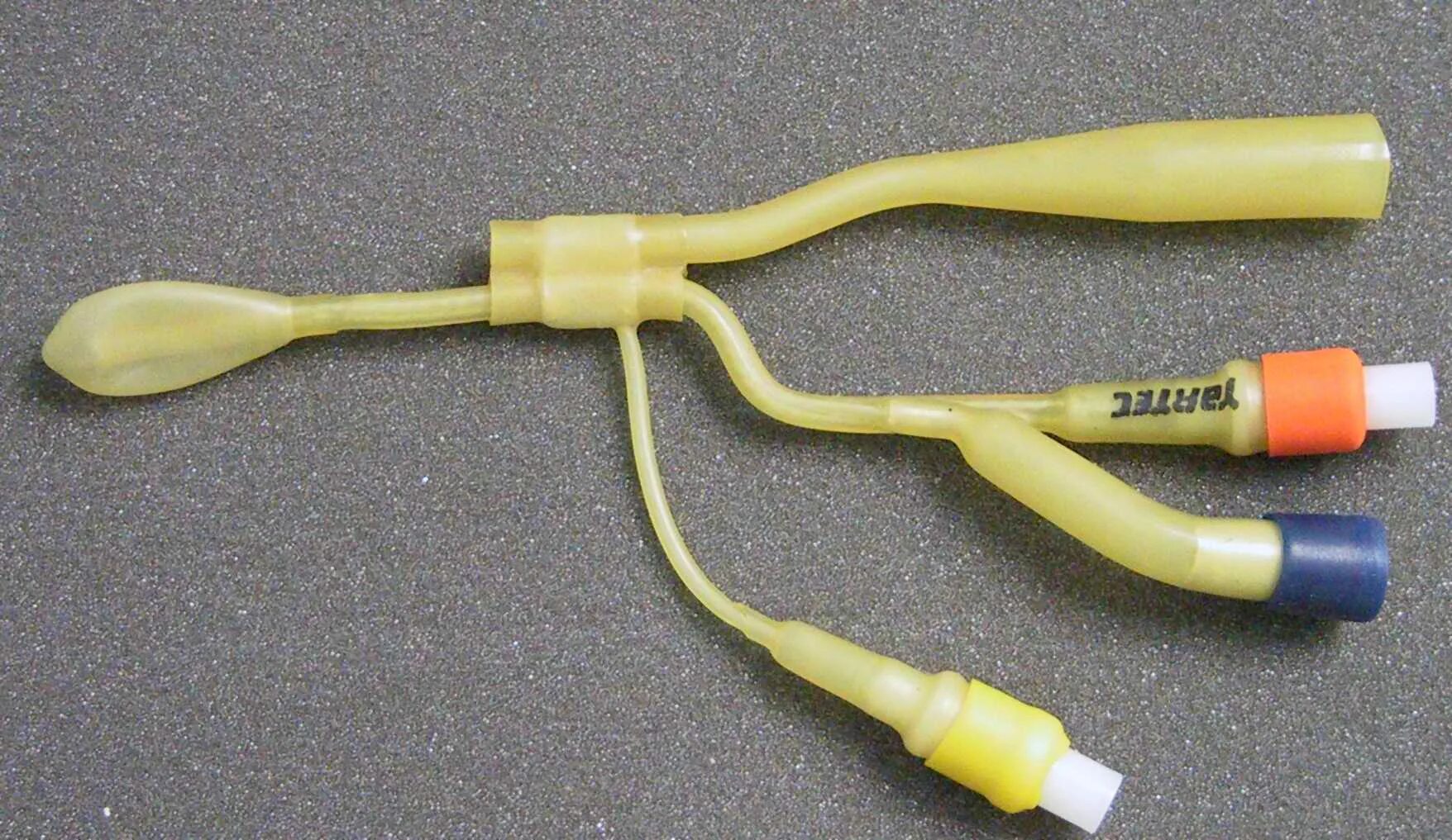 ямик катетер. назальный катетер «ямик-3». ямик катетер. промывание пазух ямик катетером. промывание пазух ямик катетером.