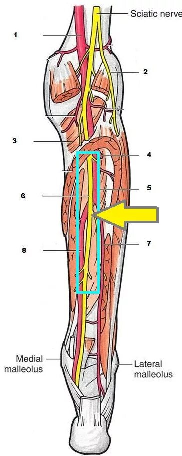 Canalis cruropopliteus анатомия. Верхний мышечно малоберцовый канал топография. Каналы голени топографическая анатомия. Стенки верхнего мышечно-малоберцового канала.