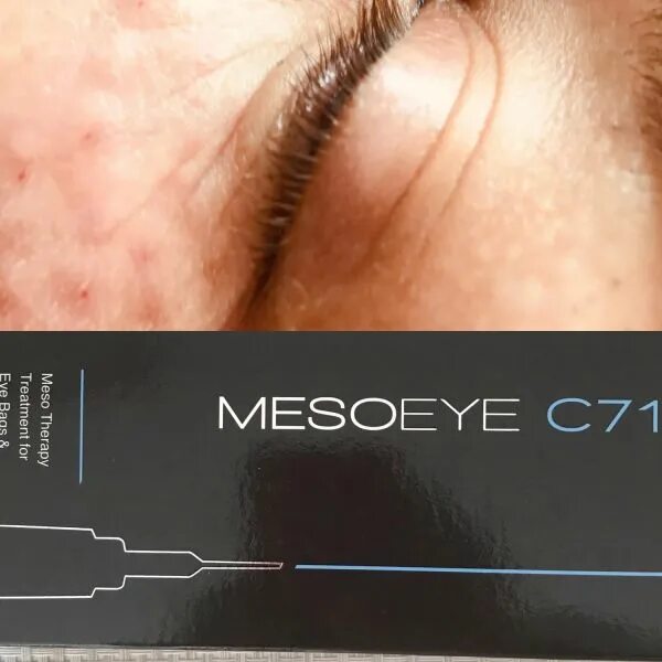 Mesoeye c71 отзывы - забота о коже лица - сайт отзывов из россии
