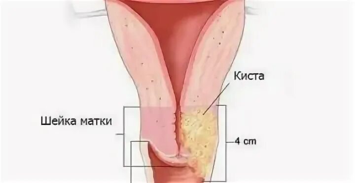 Почему колет матку