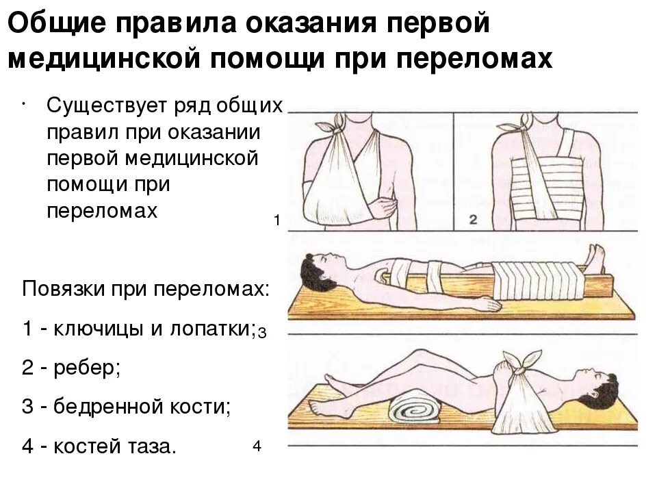 При открытом переломе необходимо ответ. Оказание первой помощи доврачебной помощи при переломах. Порядок оказания ПМП при переломах. Оказание первой медицинской помощи при ушибах и переломах. Навыки оказания первой медицинской помощи при переломах.