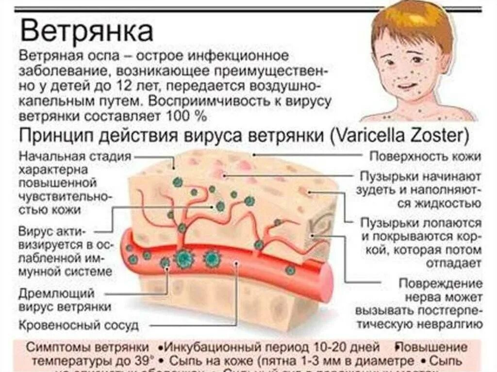 Насколько заразна. Ветряная оспа болезнь симптомы у детей. Герпесовидная ветрянка. Ветряная оспа высыпания сыпь. Dtnhzyyyyfz JCGF E ltntq.