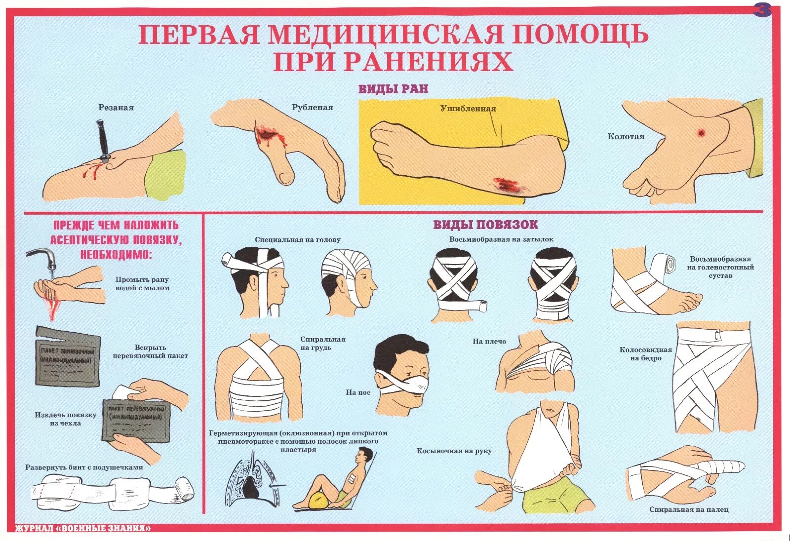 Классный час оказание первой помощи. Оказание первой помощи при ранениях и кровотечениях. Порядок оказания первой помощи пострадавшему при ранении:. Правила оказания 1 помощи пострадавшему при ранениях. Порядок оказания первой мед помощи при ранении.