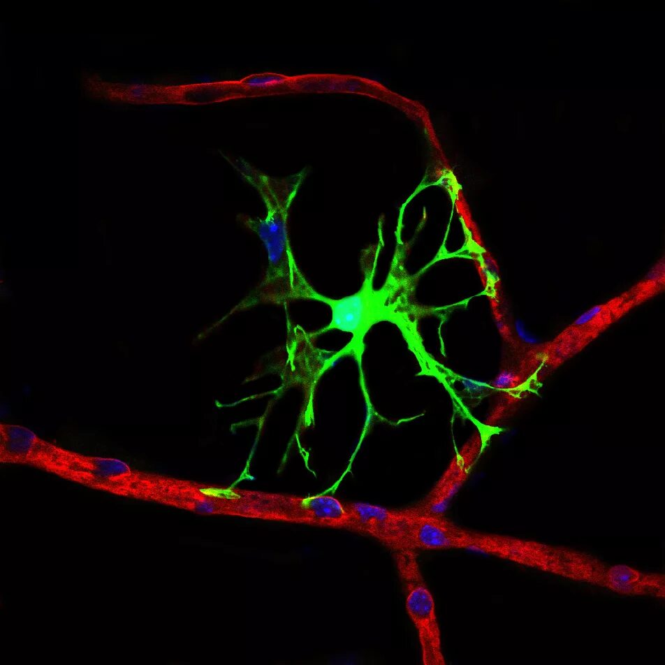Астроцит клиника. Клетки головного мозга астроциты. Астроциты Конфокал. Астроциты и олигодендроциты. Конфокальная микроскопия микроглиальных клеток.