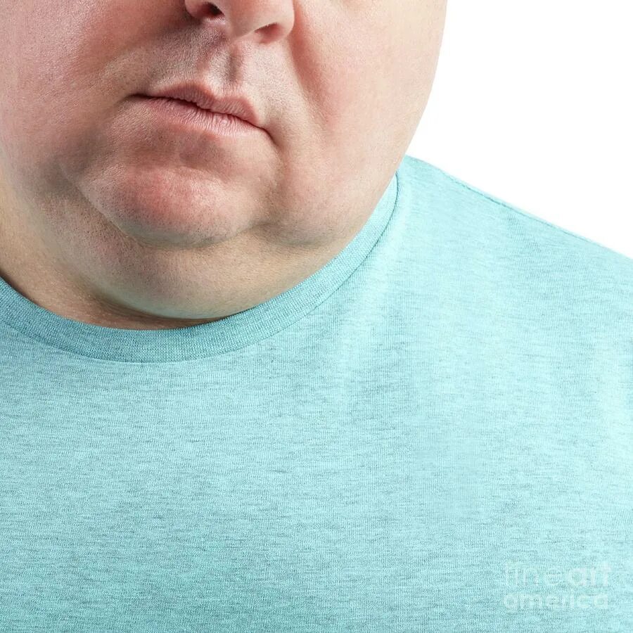 Грустный толстый человек. Мужчина с ожирением на весах. Алиментарное ожирение у женщин. Ожирение при синдроме иценко-кушинга характеризуется. Толстый человек ест фастфуд.