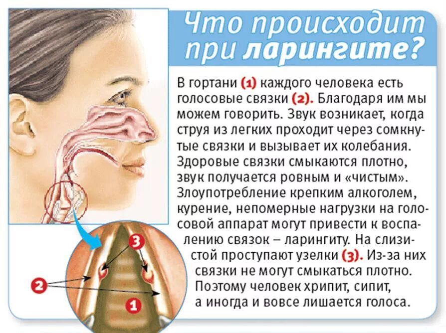 Мокрота при ларингите. Заболевание органов дыхания ларингит. при ларингите у взрослых.