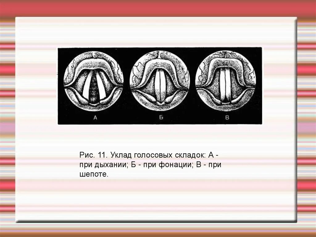 Голосовые складки при фонации. Уклад голосовых складок. Уклад голосовых связок. Голосовая щель при фонации. При разговоре шепотом голосовые связки