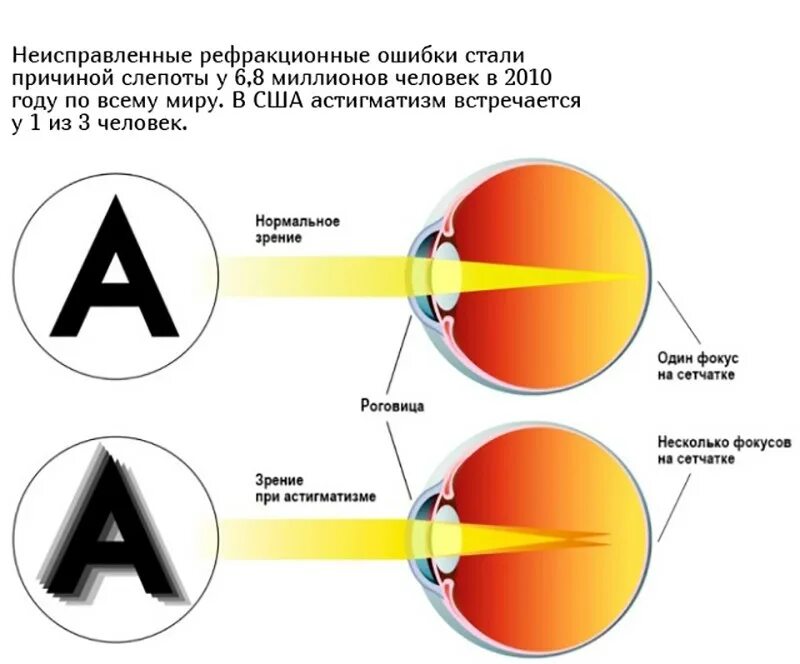 Глаз с миопией астигматизмом. Признаки учителя. Миопин. С точки зрения нормального человека. Мораль нормы морали нравственность.