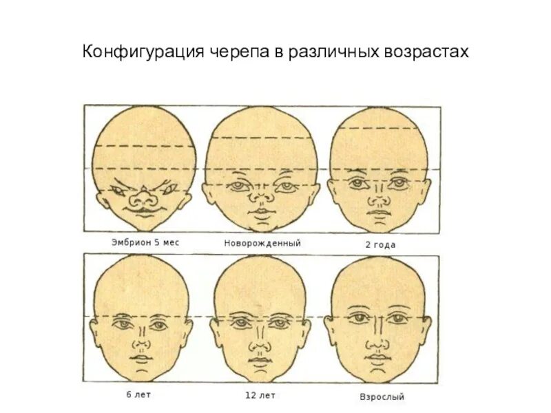 Основным признаком возрастных изменений костей. Конфигурация черепа в различных возрастах. Изменение черепа с возрастом. Череп человека в разном возрасте. Нормальная форма черепа.