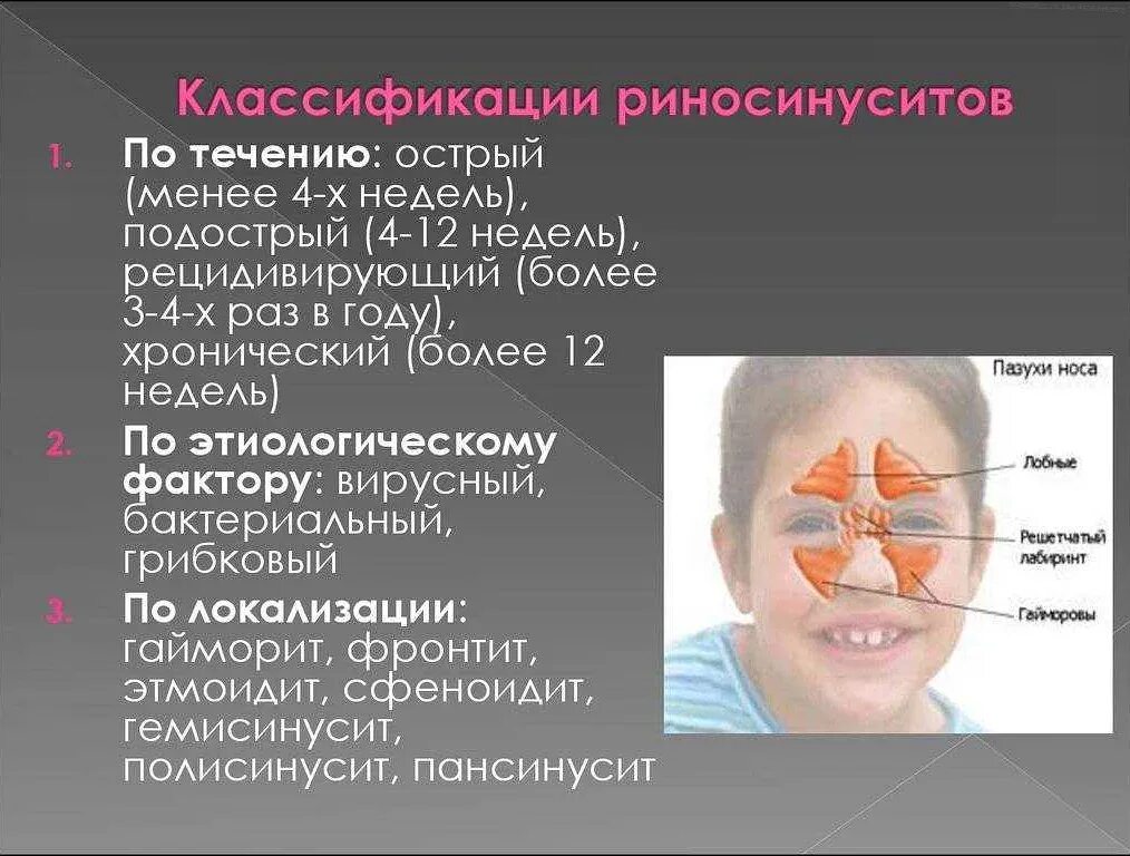 Фронтит что. Острый фронтит острый синусит. острый гнойный пансинусит симптомы. острый синусит симптомы. острый риносинусит симптомы.