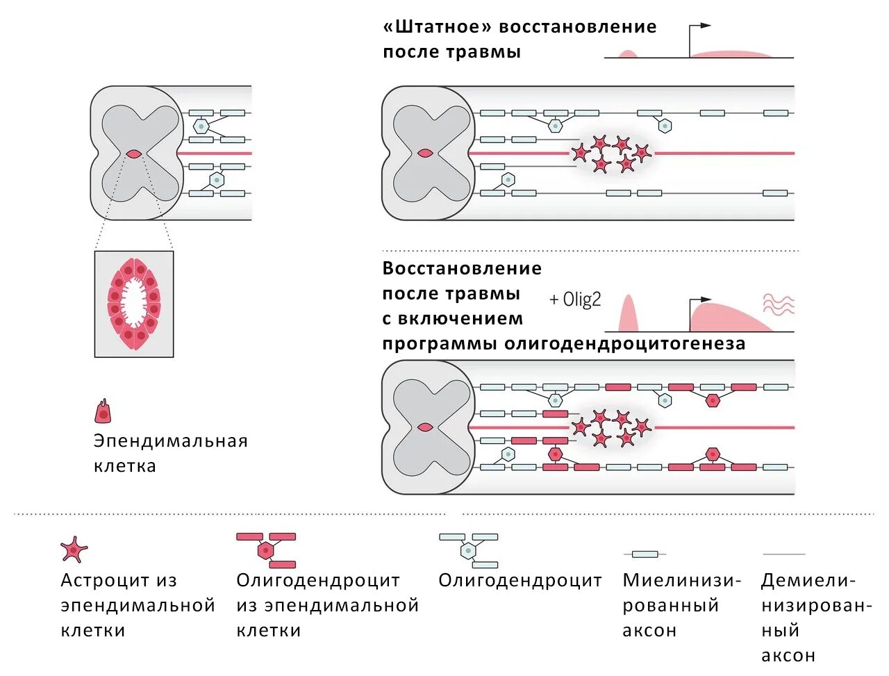 Пересадка клеток мозга. Восстановление клеток. Трансплантация клеток. Трансплантация стволовых клеток. Трансплантация стволовых клеток в спинной мозг.