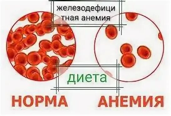 Анемия что лучше принимать